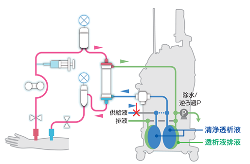 緊急時返血機能